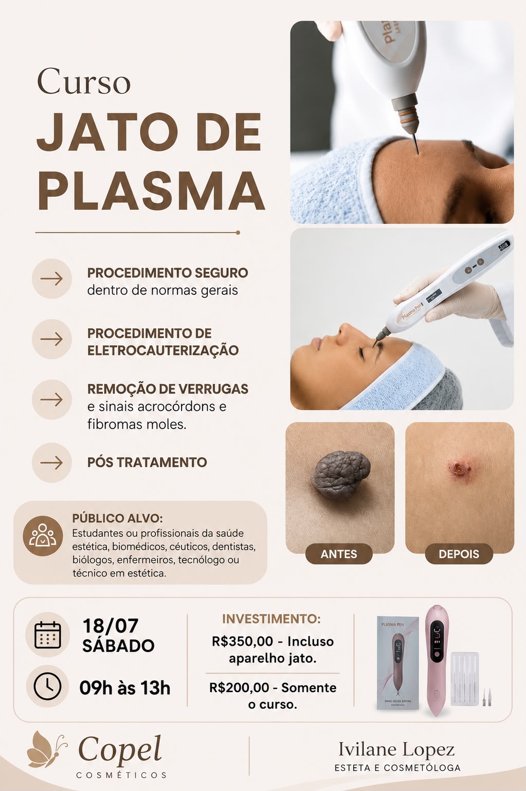 Curso Jato de Plasma